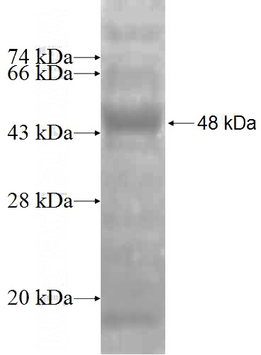 Recombinant Human AP3M1 SDS-PAGE