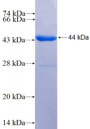 Recombinant Human CFP SDS-PAGE
