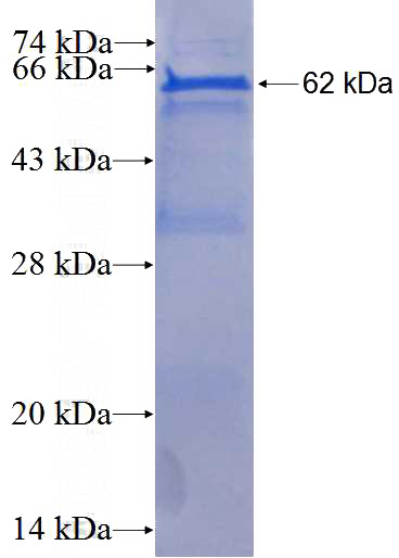 Recombinant Human WNT2 SDS-PAGE
