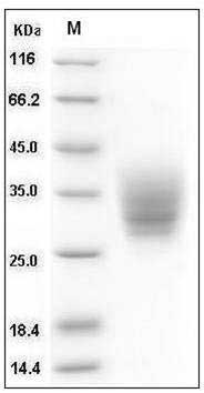 Mouse CD147 / EMMPRIN / Basigin Protein (His Tag) SDS-PAGE