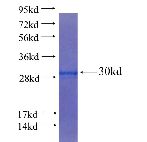 Recombinant human RHOV SDS-PAGE