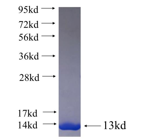 Recombinant human PRY SDS-PAGE