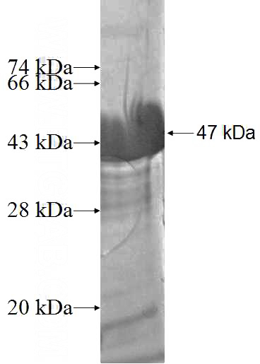 Recombinant Human ARL11 SDS-PAGE