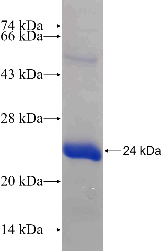 Recombinant Human MCC SDS-PAGE
