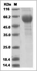 Mouse TREM-2 / TREM2 Protein (Fc Tag) SDS-PAGE
