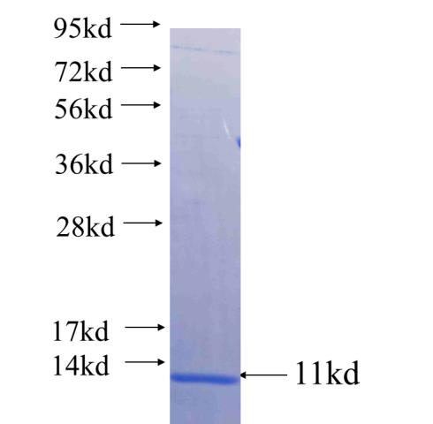 Recombinant human CLCN5 SDS-PAGE