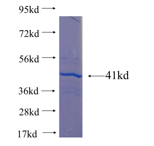 Recombinant human C6orf125 SDS-PAGE
