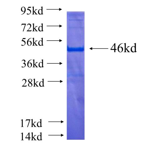 Recombinant human PLDN(Full length) SDS-PAGE