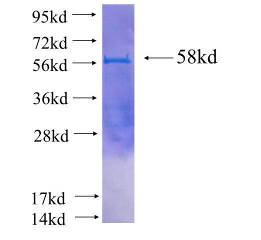 Recombinant human ROGDI(Full length) SDS-PAGE