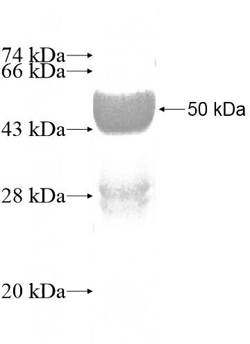 Recombinant Human LARP2 SDS-PAGE
