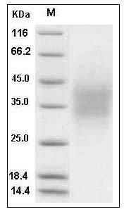Human CD300A / CMRF-35H / IGSF12 Protein (His Tag) SDS-PAGE