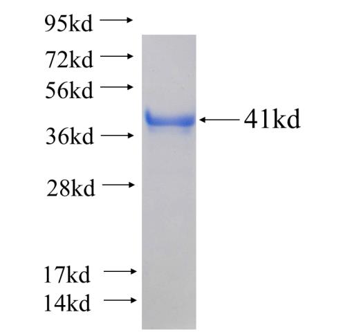 Recombinant human CPNE5 SDS-PAGE