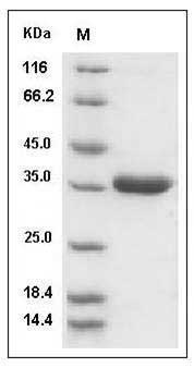 Mouse Prostasin / PRSS8 Protein (aa 30-289, His Tag) SDS-PAGE
