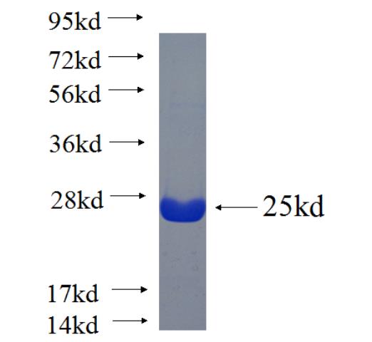Recombinant human RRN3 SDS-PAGE