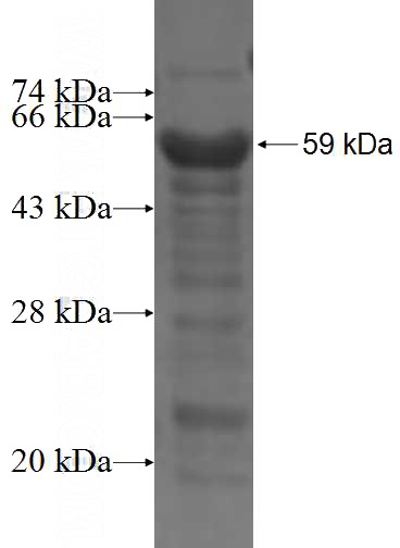 Recombinant Human RASSF4 SDS-PAGE