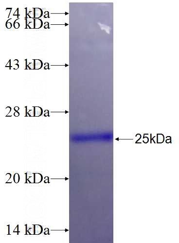 Recombinant Human LRRFIP2 SDS-PAGE