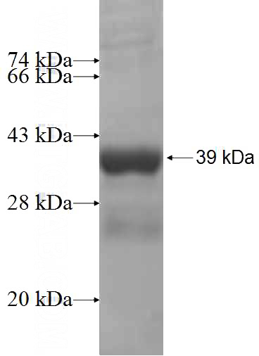 Recombinant Human NDUFS5 SDS-PAGE