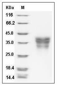 Human EDAR / DL Protein (His Tag) SDS-PAGE