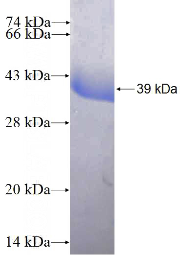 Recombinant Human MTPN SDS-PAGE