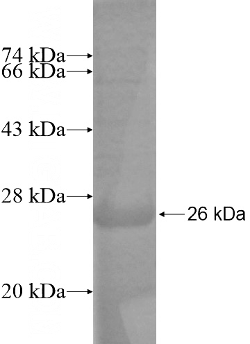 Recombinant Human DDX49 SDS-PAGE