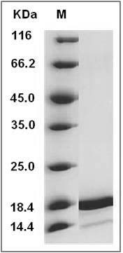 Human IL1F6 / IL36 Protein (aa 6-158) SDS-PAGE