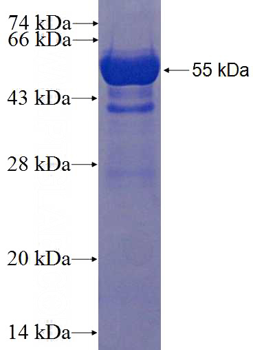 Recombinant Human IRAK1BP1 SDS-PAGE