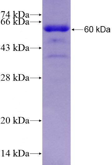 Recombinant Human RAD23B SDS-PAGE