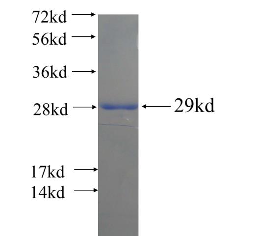 Recombinant human ZNF184 SDS-PAGE