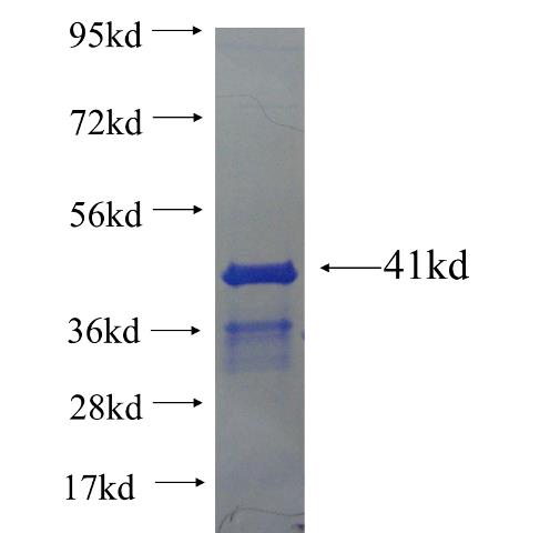 Recombinant human MYT1 SDS-PAGE