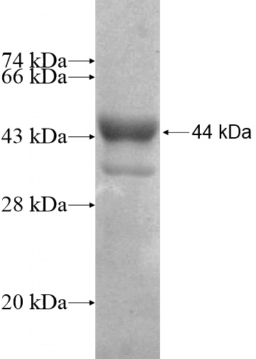Recombinant Human KRT6B SDS-PAGE
