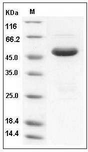 Human SETD7 / SET7/9 Protein (His Tag) SDS-PAGE