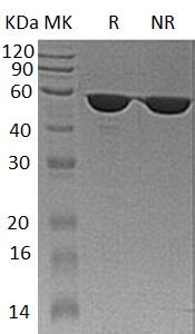 Human FKBP4/FKBP52 (His tag) recombinant protein