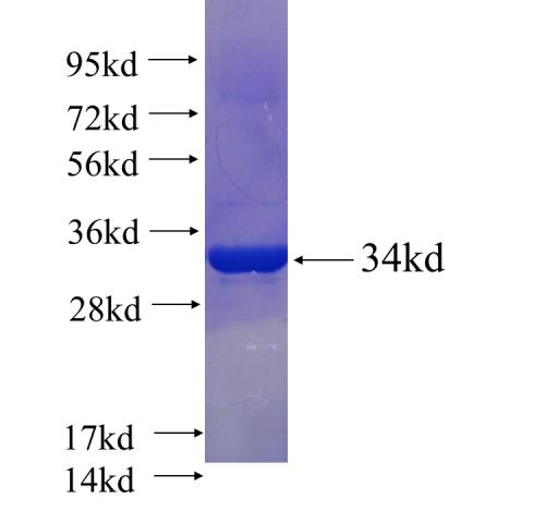 Recombinant human GTF2H5 SDS-PAGE