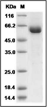 Human tPA / PLAT Protein (Fc Tag) SDS-PAGE