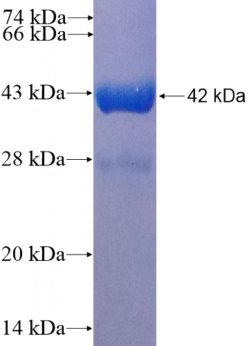 Recombinant Human Calbindin SDS-PAGE