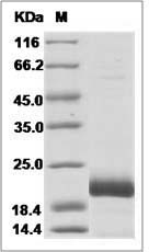 Human IL-28B / IFN-lambda-3 Protein (His Tag)