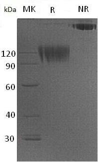 Mouse Sirpa/Ptpns1/mCG_9902 (Fc tag) recombinant protein