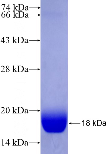Recombinant Human CREBZF SDS-PAGE