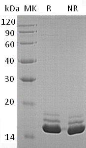 Human CST3 (His tag) recombinant protein