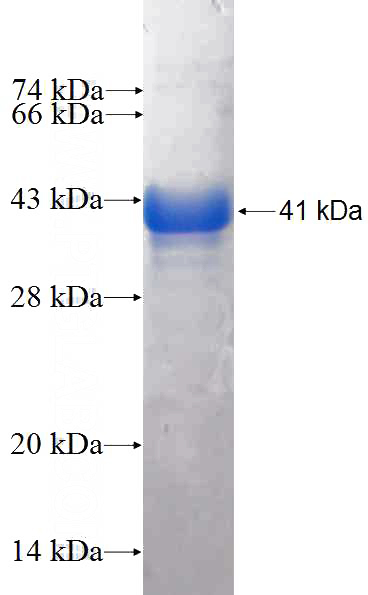 Recombinant Human LRDD SDS-PAGE