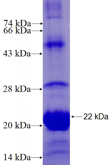 Recombinant Human KLF4 SDS-PAGE