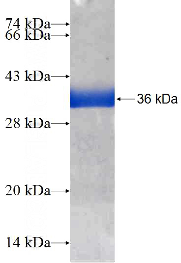 Recombinant Human SNRPF SDS-PAGE