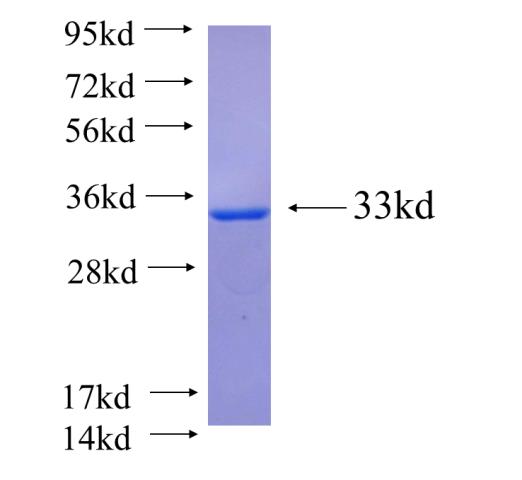 Recombinant human ERC2 SDS-PAGE