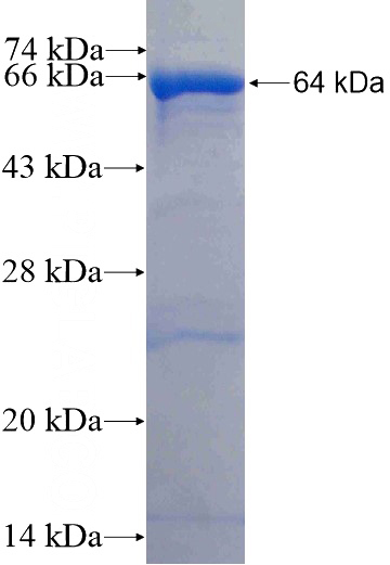 Recombinant Human NOMO1 SDS-PAGE