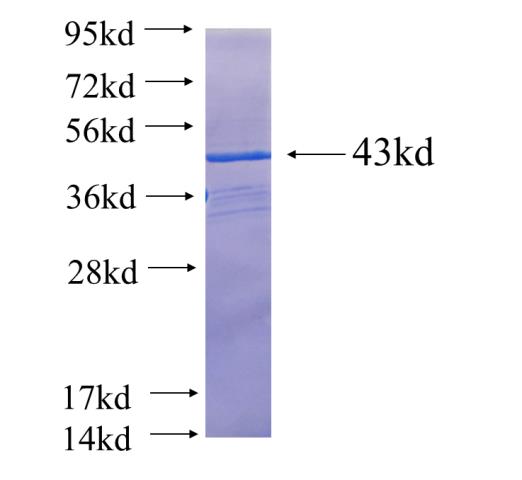 Recombinant human RBM47 SDS-PAGE