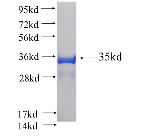 Recombinant human CNN2 SDS-PAGE