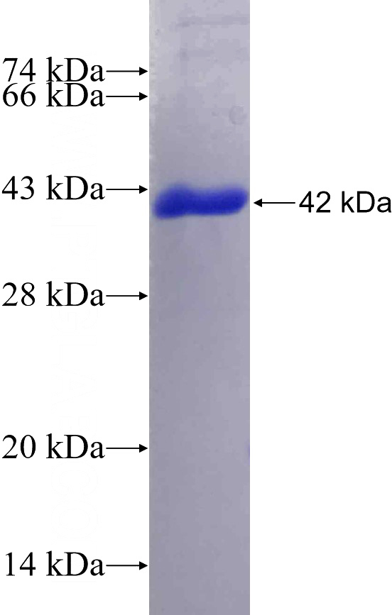 Recombinant Human TAF6L SDS-PAGE