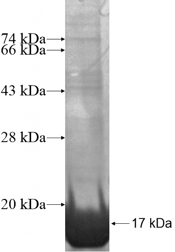 Recombinant Human USP36 SDS-PAGE