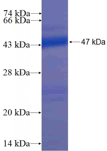Recombinant Human ARL1 SDS-PAGE