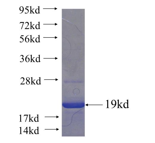 Recombinant human CCK SDS-PAGE
